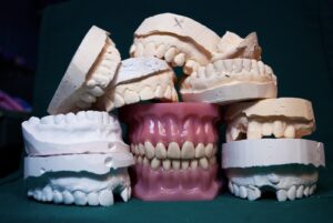 Was ist eine Zahnschiene? Unsichtbare Lösung für ein strahlendes Lächeln